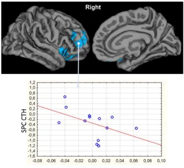 Fig.  6a:  Changes  in  cortical  thickness  correlated  with  changes  in  Beck  Depressive  Inventory in 12 patients