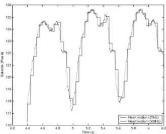 Figure II.2 : The heart motion sampled at 500 Hz and 25 Hz: information loss at 25 Hz due to aliasing is not negligible.