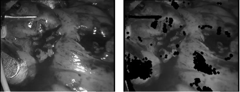 Figure II.9 : The proposed specular detection method. The pixels on the original image (left) aected by specular reections are painted in black (right)