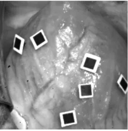 Fig. 1.18 – Patches utilisés pour le suivi de cœur battant dans [Sauvée, 2006].