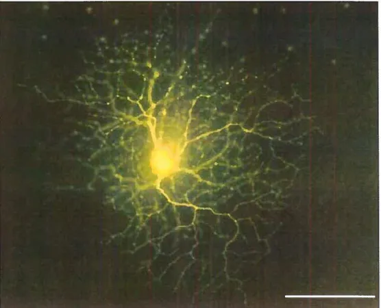 Figure 2: Image of a starburst amacrine celi from a rabbit retina labeled with Lucifer yellow