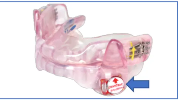 Figure 4.  SomnoDent FlexÔ device with embedded DentitracÒ microchip. 