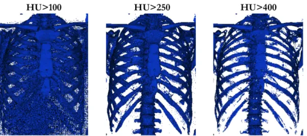 Figure I.7 – Différents seuillages sur un CT-scan de thorax : densité supérieure à 100 HU, à 250 HU et à 400 HU.