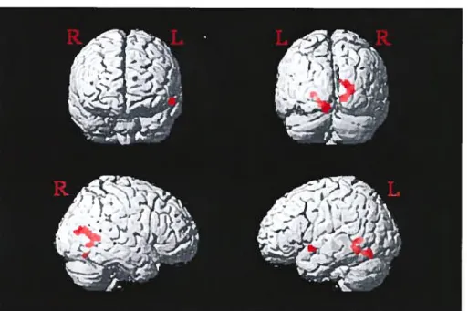 Figure 3: Priming-dependent BOLU signal changes on rendered cortex