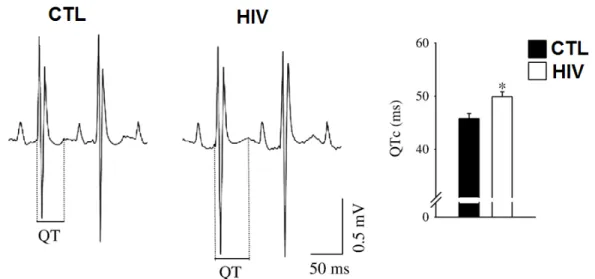 Figure  10.  ECG  of  Control  and  HIV  Mice.  Representative examples  of  ECG  recording  (left) and mean data (right) obtained from control and HIV mice which exhibit a significant  (*) increase in QT interval