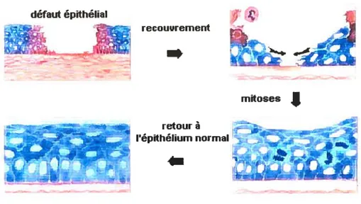 Figure 3. Guérison d’une lésion épithéliale simple