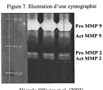 Figure 7. Illustration d’une zymographie