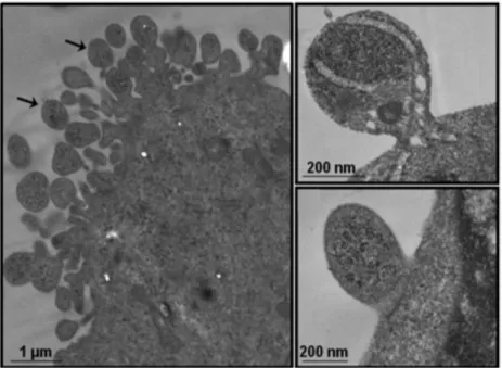 Fig. 7 : Bourgeonnement et libération des microparticules à partir de  la  membrane  plasmique  de  la  cellule  –  image  par  microscopie  électronique en transmission (Doeuvre et al