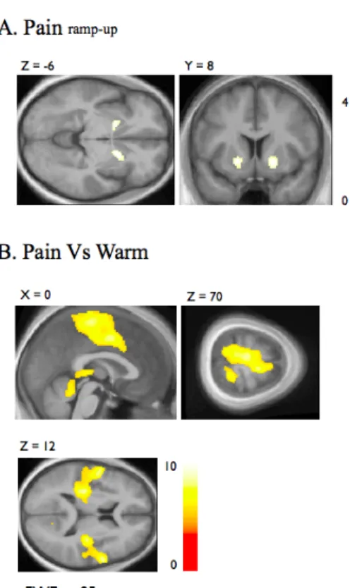 Figure  3:  A.  The  [Pain ramp-up ]  condition  elicited  a  BOLD-signal  response  in  the  NAc