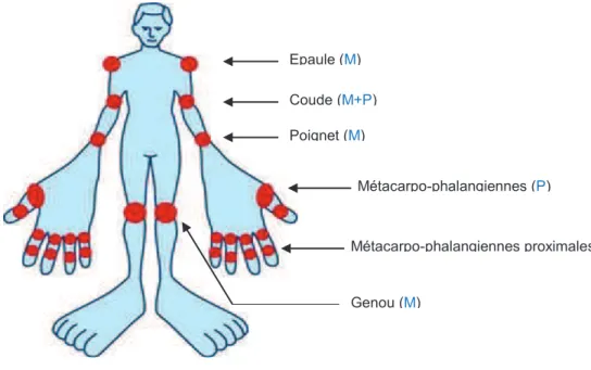 Figure  6 .  Les  28  sites  articulaires  proposés  par  l’EULAR pour  calculer  le  DAS28: les  sites  sont  évalués par mobilisation (M) ou par pression (P)