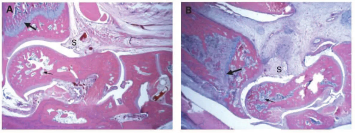 Figure  16.   Radiographie  aux  rayons  X  des  pattes  de  rats  à  33  jours  post-immunisation