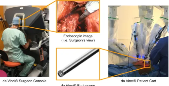 Figure 1.5 – Robot-assisted laparoscopic colorectal surgery using a da Vinci ® surgical plat- plat-form.