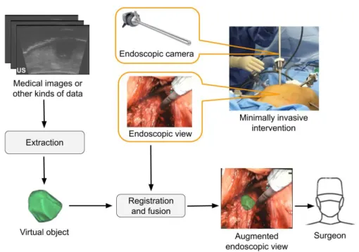 Figure 2.1 – The procedure of implementing an AR system in minimally invasive surgery.
