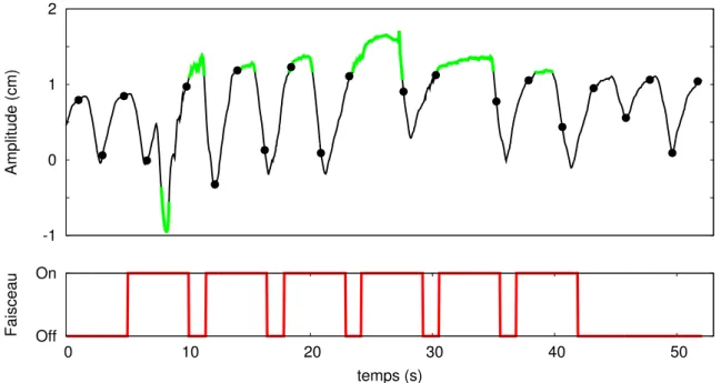 Figure 1.3 – Signal RPM obtenu apr` es acquisition sur un scanner 4D