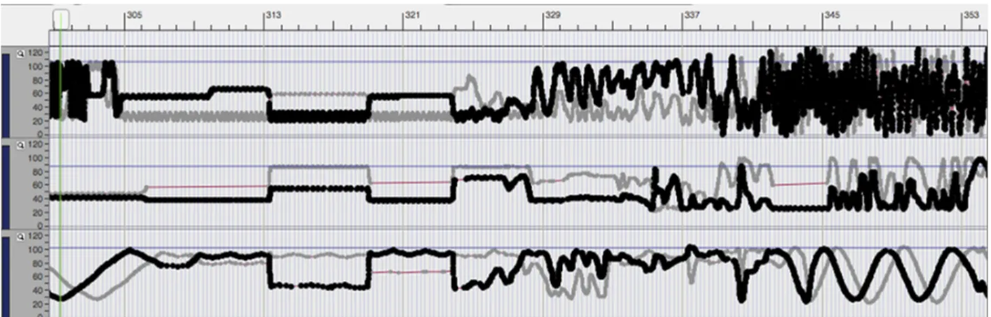 Figure 10 : coordonnés des canaux 1, 3 et 5 vers 10 minutes. 