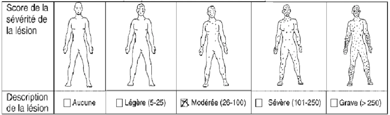 Figure 5: Classification des cas de MPX en fonction du score de sévérité des lésions cutanées  selon l’OMS (Breman et al., 1980)