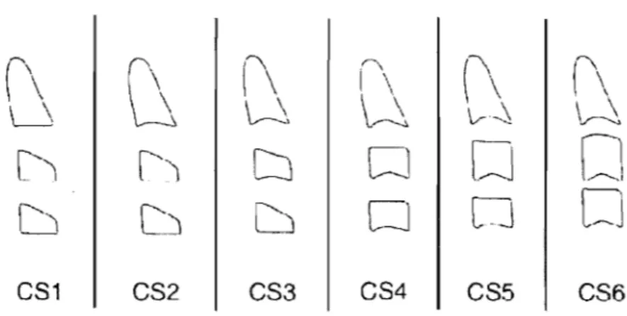 Figure 3  :  Les six stades de la  maturation des  vertèbres cervicales (CVM)  Adapté de  Baccetti et al.,  Sernin  Orthod, 2005