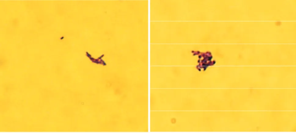 Figure  5 :  Observation  de  M.  immunogenum  en  microscopie  optique  coloration  de  Gram,  objectif x 100 (Source : J.B