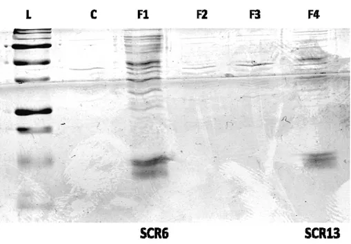 Figure 10 : Électrophorèse sur gel SDS-PAGE des différentes fractions du surnageant suite  au choc osmotique