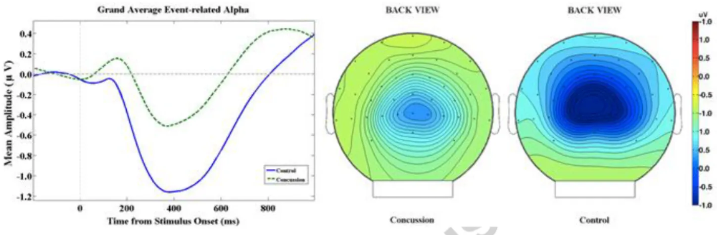 Figure 1: A) Baseline-corrected dynamics of the grand average alpha amplitude recorded at Oz (in the interval from 350–