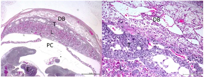 Figure 6. Morphologie placentaire. 