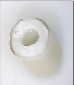 Figure 16. Perle de verre du site Louis démontrant  une couche de verre transparente. 