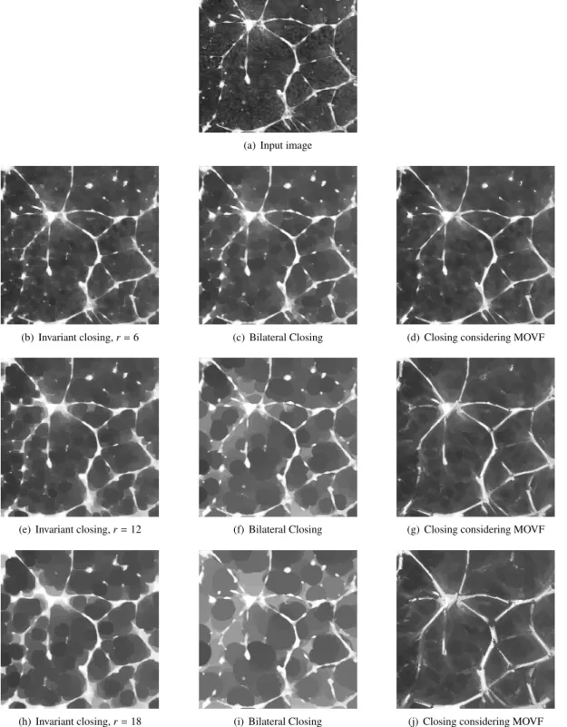 Figure 9: Comparison of closings with different sizes. (a) Input image: 256 × 256 gray level image of a cell