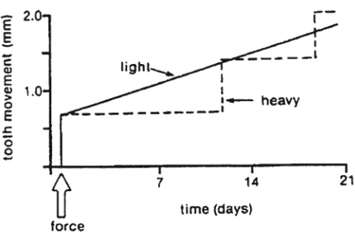 Figure 2.1 . Résorption frontale et sapante produites respectivement par des forces légères ou lourdes (Froffit, 2000)