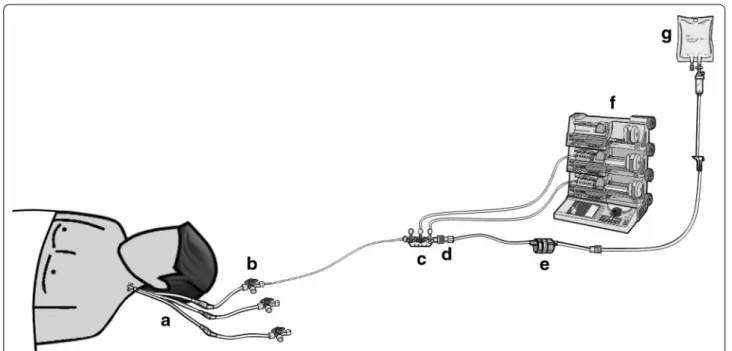 Fig. 1  Infusion line setup. a Multilumen central venous catheter (Arrow, Kingston, UK); b infusion line (BD Medical, Le Pont de Clais, France) con‑