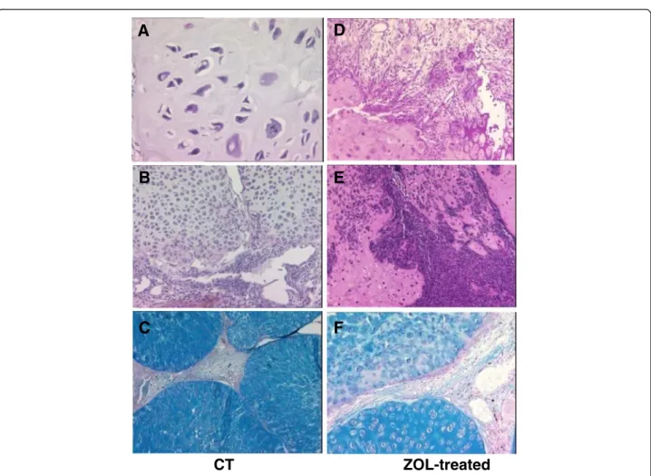 Figure 2 Histological analysis of tumor tissue at the end of the study: control (A to C) and ZOL-treated (D to F) groups