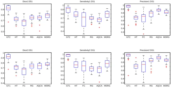 Figure 9: Segmentation evaluation for DS1 relatively to the first human observer (first row) and the second human observer (second row) : dice (left), sensitivity (middle) and precision (right).