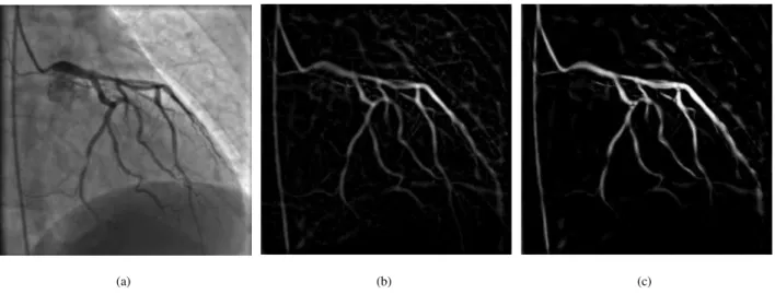 Figure 1: Vessel enhancement with two different filters: (a) original image; and images enhanced by the (b) Sato and (c) Frangi filters.