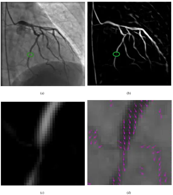 Figure 2: Motivating sample: (a) original image; (b) Frangi vesselness response; (c) vesselness in the green circle; (d) corresponding first eigen- eigen-vector field.