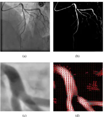 Figure 2. Hessian-based features: (a) original image; (b) Frangi vesselness response; (c) a small part of the original image; (d) corresponding first eigenvector field superimposed to the vesselness response.