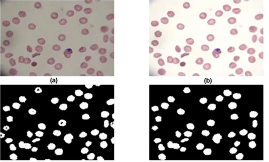 Figure 6 Single erythrocyte samples. From left to right: two healthy erithrocytes, two erythrocytes  infected with ring stage parasites, two erythrocytes infected with throphozoite stage parasites and two  erythrocytes infected with schizont stage parasite