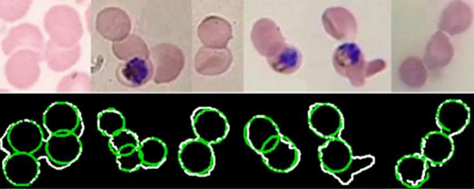 Figure 8 Splitting of clumped cells. Top: Original overlapped cells. Down: splitting results