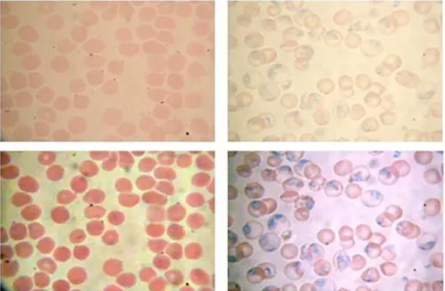 Figure 3 Image enhancement approaches. Fist row corresponds to the original images. Bottom row  displays enhanced images obtained by application of an unsharp masking followed by a color median  filter (left), and the color normalization process proposed b