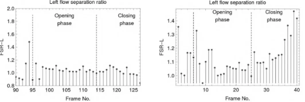 Fig. 3 shows the computational and experimental results for the left separation ratio FSR- FSR-L