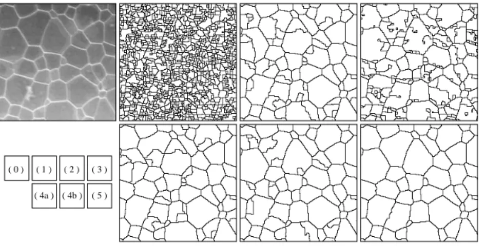Fig. 5. Results of the watershed with parameters. (0) Original image (200 x 200 x 8 bits).