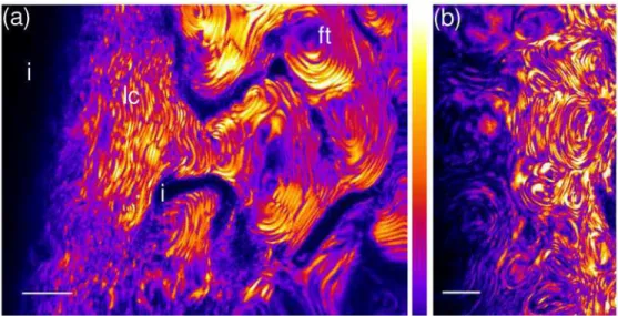 Fig. 6. SHG  Images  of a liquid crystalline collagen solution in chloride acid: (a) pH=3.5, (b)  pH=2.5 (Media 1) showing loose cholesteric pattern with few defects (lc), fingerprint texture  (ft) and isotropic areas (i)