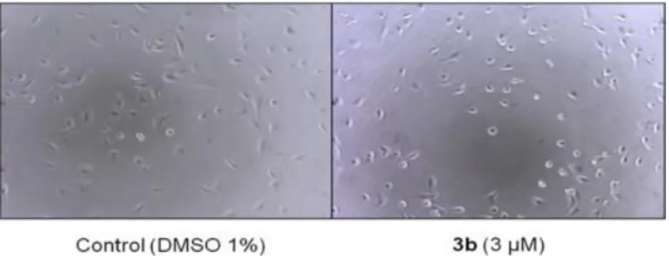 Fig. 2. Representative photographs depicting the morphological effects of compound 3b on endothelial cells (EAhy 926)