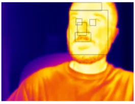 Fig. 2: ROIs in the thermal data. Temperatures range from 20 ◦ C in dark purple to 40 ◦ C in light yellow