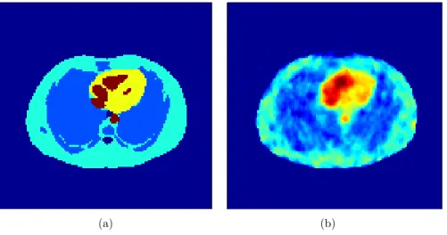 Figure 2. Simulated PET reconstruction with the split-gradient method. (a) Simulated PET phantom