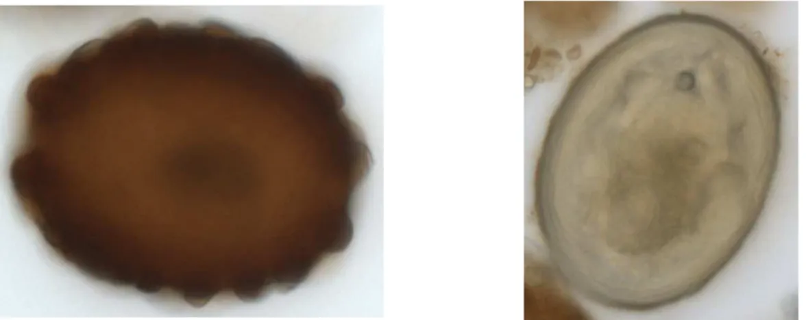 Figure 4 : Embryophore de  Taenia/Echinococcus sp. 