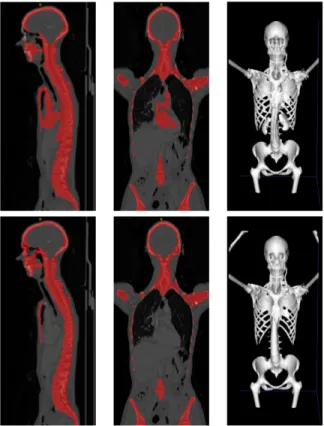 Fig. 2. Illustration of the true positives, false positives and false negatives computation on the spine