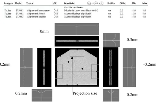 Figure 17 shows the automatic and the “Step by Step” results of the LAP phantom control process.