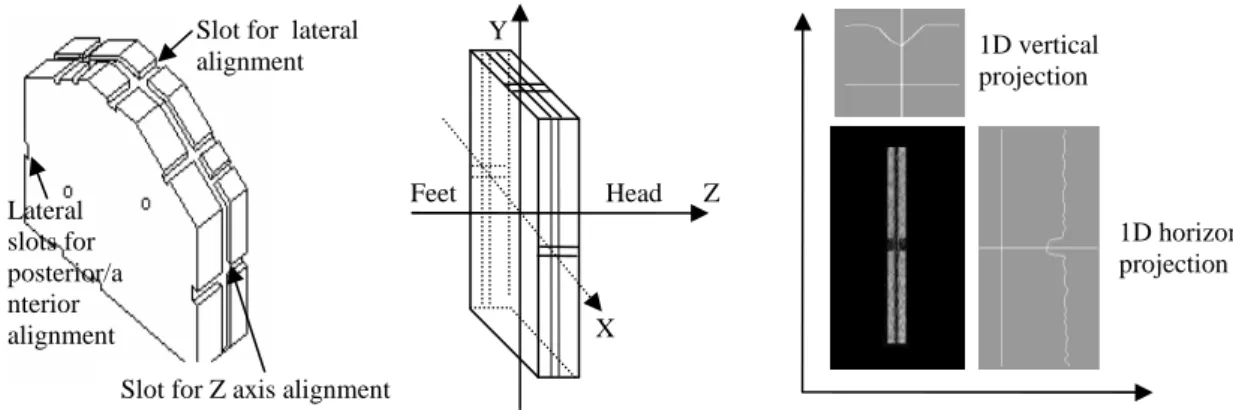 Figure 7. An outline representing the process of calculating LAP phantom misalignment