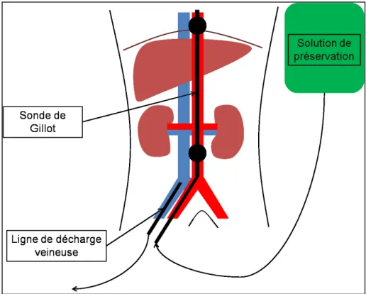 Figure 1 : Principe du refroidissement in situ. 