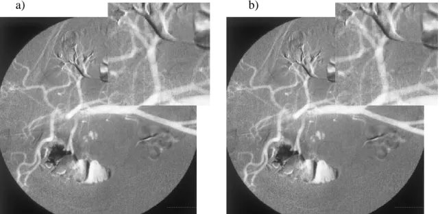 Figure 5: a) Source image - b) Image with inserted payload 