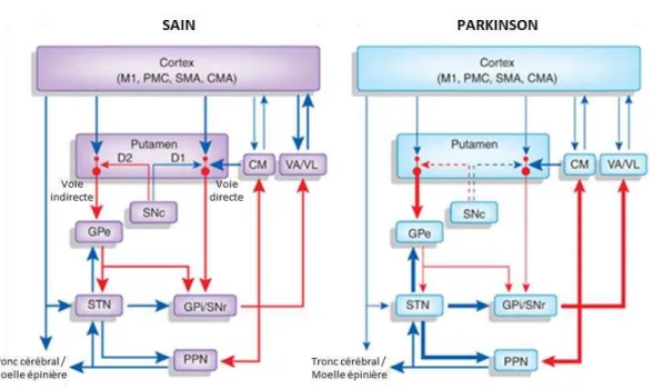 Figure 5: Représentation graphique de la connectivité des ganglions de la base chez une personne saine  et un malade parkinsonien